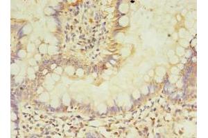 Immunohistochemistry of paraffin-embedded human small intestine tissue using ABIN7144191 at dilution of 1:100 (ASB6 anticorps  (AA 1-197))