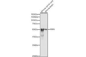 Western blot analysis of extracts of various cell lines, using PRPH antibody (ABIN1682318, ABIN3018463, ABIN3018464 and ABIN6220472) at 1:500 dilution. (Peripherin anticorps  (AA 1-260))
