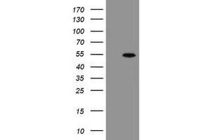 Western Blotting (WB) image for anti-rho GTPase Activating Protein 2 (ARHGAP2) antibody (ABIN1499632) (CHN1 anticorps)