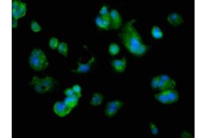 Immunofluorescence staining of MCF-7 cells with ABIN7144607 at 1:166, counter-stained with DAPI. (ARMC1 anticorps  (AA 28-160))