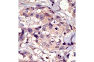 Image no. 1 for anti-Platelet Derived Growth Factor Receptor alpha (PDGFRA) (C-Term) antibody (ABIN359906) (PDGFRA anticorps  (C-Term))