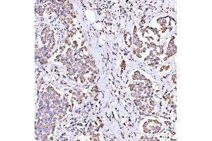 IHC analysis of SUCLG1 using anti-SUCLG1 antibody (ABIN7600906). (SUCLG1 anticorps  (AA 25-346))