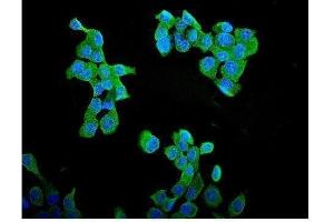 IF analysis of CCNB1 using anti-CCNB1 antibody (ABIN3043482). (Cyclin B1 anticorps  (AA 1-433))