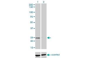 Western blot analysis of NUDT5 over-expressed 293 cell line, cotransfected with NUDT5 Validated Chimera RNAi (Lane 2) or non-transfected control (Lane 1).