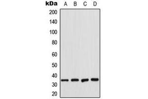 Western blot analysis of CDK2 expression in K562 (A), HeLa (B), NIH3T3 (C), rat heart (D) whole cell lysates. (CDK2 anticorps  (Center))