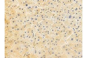 ABIN6263864 and ABIN6272726 at 1/100 staining human normal liver tissue by IHC-P.