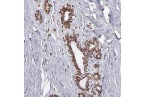 Immunohistochemical staining of human breast with KIAA0020 polyclonal antibody  shows nuclear membranous positivity in glandular cells at 1:50-1:200 dilution. (KIAA0020 anticorps)