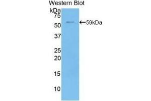 Detection of recombinant CD73 using Polyclonal Antibody to Cluster Of Differentiation 73 (CD73) (CD73 anticorps  (AA 29-550))
