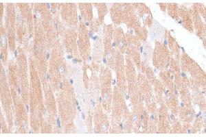 Immunohistochemistry of paraffin-embedded Mouse heart using KATNA1 Polyclonal Antibody at dilution of 1:100 (40x lens). (KATNA1 anticorps)