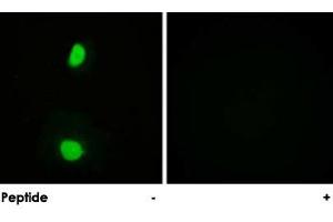 Immunofluorescence analysis of HeLa cells, using KAT5 polyclonal antibody . (KAT5 anticorps)