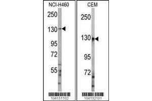 Western blot analysis of anti-UBE4A Antibody in NCI-H460 and CEM cell line lysates (35ug/lane) (UBE4A anticorps  (C-Term))