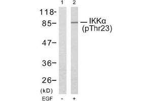 Image no. 2 for anti-conserved Helix-Loop-Helix Ubiquitous Kinase (CHUK) (pThr23) antibody (ABIN196836) (IKK alpha anticorps  (pThr23))