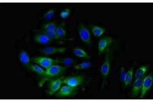 Immunofluorescent analysis of A549 cells using ABIN7143668 at dilution of 1:100 and Alexa Fluor 488-congugated AffiniPure Goat Anti-Rabbit IgG(H+L) (ALDH3B1 anticorps  (AA 168-449))