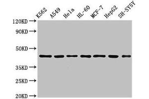 Western Blot Positive WB detected in: K562 whole cell lysate, A549 whole cell lysate, Hela whole cell lysate, HL60 whole cell lyasate, MCF-7 whole cell lysate, HepG2 whole cell lysate, SH-SY5Y whole cell lysate All lanes: TARDBP antibody at 2. (TARDBP anticorps  (AA 1-396))