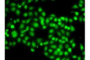 Immunofluorescence analysis of A-549 cells using SETBP1 antibody (ABIN6132919, ABIN6147635, ABIN6147636 and ABIN6223042). (SETBP1 anticorps  (AA 1-242))