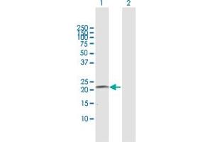 Western Blot analysis of CYP4A11 expression in transfected 293T cell line by CYP4A11 MaxPab polyclonal antibody.