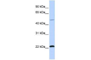 WB Suggested Anti-WWP2 Antibody Titration:  0. (WWP2 anticorps  (C-Term))