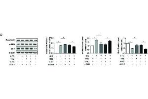 Trimetazidine (TMZ) reduced HFG-induced ROS generation and EMT depending on upregulation of Sirt1. (SIRT1 anticorps  (AA 448-747))