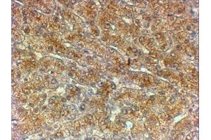 ABIN2613388 (2µg/ml) staining of paraffin embedded Human Liver. (ATG4A anticorps  (Internal Region))