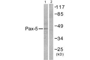 Western Blotting (WB) image for anti-Paired Box 5 (PAX5) (N-Term) antibody (ABIN1848733) (PAX5 anticorps  (N-Term))