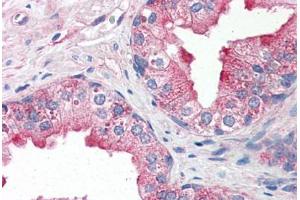 Human Prostate (formalin-fixed, paraffin-embedded) stained with TNFRSF25 antibody ABIN343911 at 10 ug/ml followed by biotinylated goat anti-rabbit IgG secondary antibody ABIN481713, alkaline phosphatase-streptavidin and chromogen. (DR3/LARD anticorps  (AA 25-40))