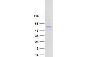 Validation with Western Blot