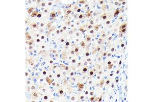 Immunohistochemistry of paraffin-embedded rat ovary using CDKN1B/p27KIP1 Rabbit mAb (ABIN7266602) at dilution of 1:100 (40x lens). (CDKN1B anticorps)