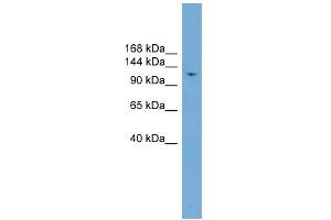WB Suggested Anti-LIG1 Antibody Titration: 0. (LIG1 anticorps  (Middle Region))