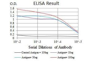 Black line: Control Antigen (100 ng), Purple line: Antigen(10 ng), Blue line: Antigen (50 ng), Red line: Antigen (100 ng),