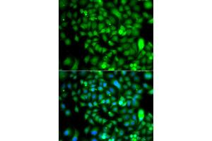 Immunofluorescence analysis of A549 cells using CSRP2BP antibody. (CSRP2BP anticorps)