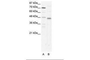 Image no. 1 for anti-Zfp-1 (AA 97-146) antibody (ABIN202318) (Zfp-1 anticorps  (AA 97-146))
