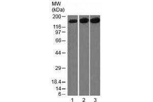 Western blot testing of 1) human HepG2, 2) HeLa and 3) mouse NIH3T3 cell lysate with Topoisomerase II alpha antibody (clone TOP2A/1361). (Topoisomerase II alpha anticorps  (AA 1352-1493))