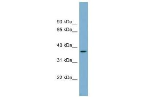 OR2W5 antibody used at 1 ug/ml to detect target protein. (OR2W5 anticorps  (Middle Region))