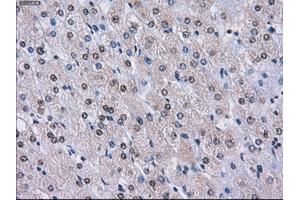 Immunohistochemical staining of paraffin-embedded endometrium tissue using anti-LOXmouse monoclonal antibody. (LOX anticorps  (AA 22-168))