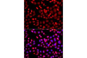 Immunofluorescence analysis of A549 cell using MTUS1 antibody. (MTUS1 anticorps)