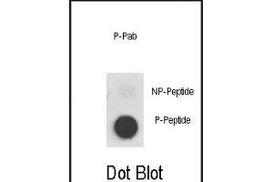 Dot blot analysis of anti-Phospho-MET-p Phospho-specific Pab (ABIN389596 and ABIN2839609) on nitrocellulose membrane. (c-MET anticorps  (pTyr1356))