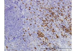 Immunoperoxidase of monoclonal antibody to GLRX on formalin-fixed paraffin-embedded human tonsil.