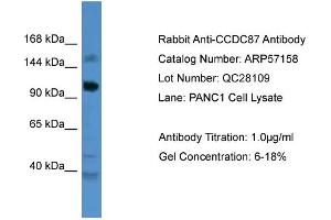 WB Suggested Anti-CCDC87  Antibody Titration: 0. (CCDC87 anticorps  (C-Term))