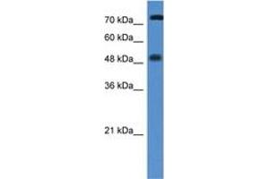 Image no. 1 for anti-Vitamin D Receptor (VDR) (AA 108-157) antibody (ABIN6746029) (Vitamin D Receptor anticorps  (AA 108-157))