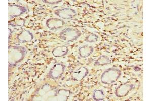Immunohistochemistry of paraffin-embedded human small intestine tissue using ABIN7149808 at dilution of 1:100 (OTUD6B anticorps  (AA 1-293))
