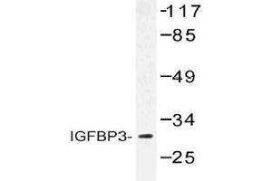Western blot (WB) analysis of IGFBP3 antibody in extracts from HUVEC cells. (IGFBP3 anticorps)