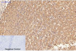 Immunohistochemical analysis of paraffin-embedded human liver tissue. (LALBA anticorps)