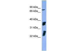 WB Suggested Anti-FGFR2  Antibody Titration: 0. (FGFR2 anticorps  (C-Term))