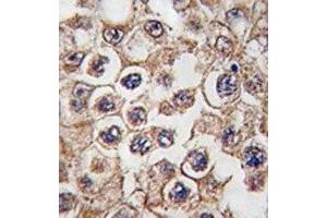 IHC analysis of FFPE human testis tissue stained with Insulin receptor-related antibody (INSRR anticorps  (AA 16-47))