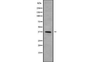 Western blot analysis GFI1B using 293 whole cell lysates (GFI1B anticorps  (Internal Region))