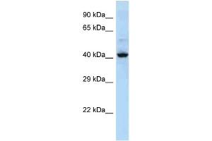 Host: Rabbit Target Name: KRT36 Sample Type: NCI-H226 Whole cell lysates Antibody Dilution: 1. (Keratin 36 anticorps  (Middle Region))