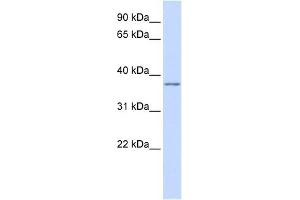 KCNAB2 antibody used at 1 ug/ml to detect target protein. (KCNAB2 anticorps  (Middle Region))
