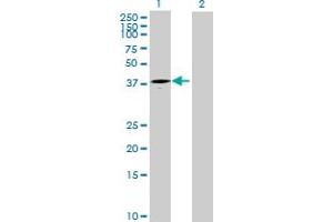 Western Blot analysis of ART4 expression in transfected 293T cell line by ART4 MaxPab polyclonal antibody.