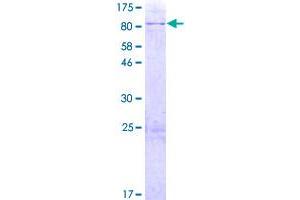 Image no. 1 for Membrane-Bound Transcription Factor Peptidase, Site 1 (MBTPS1) (AA 1-552) protein (GST tag) (ABIN1310498)