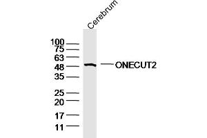 Mouse cerebrum lysates probed with ONECUT2 Polyclonal Antibody, Unconjugated  at 1:300 overnight at 4˚C. (ONECUT2 anticorps  (AA 401-504))